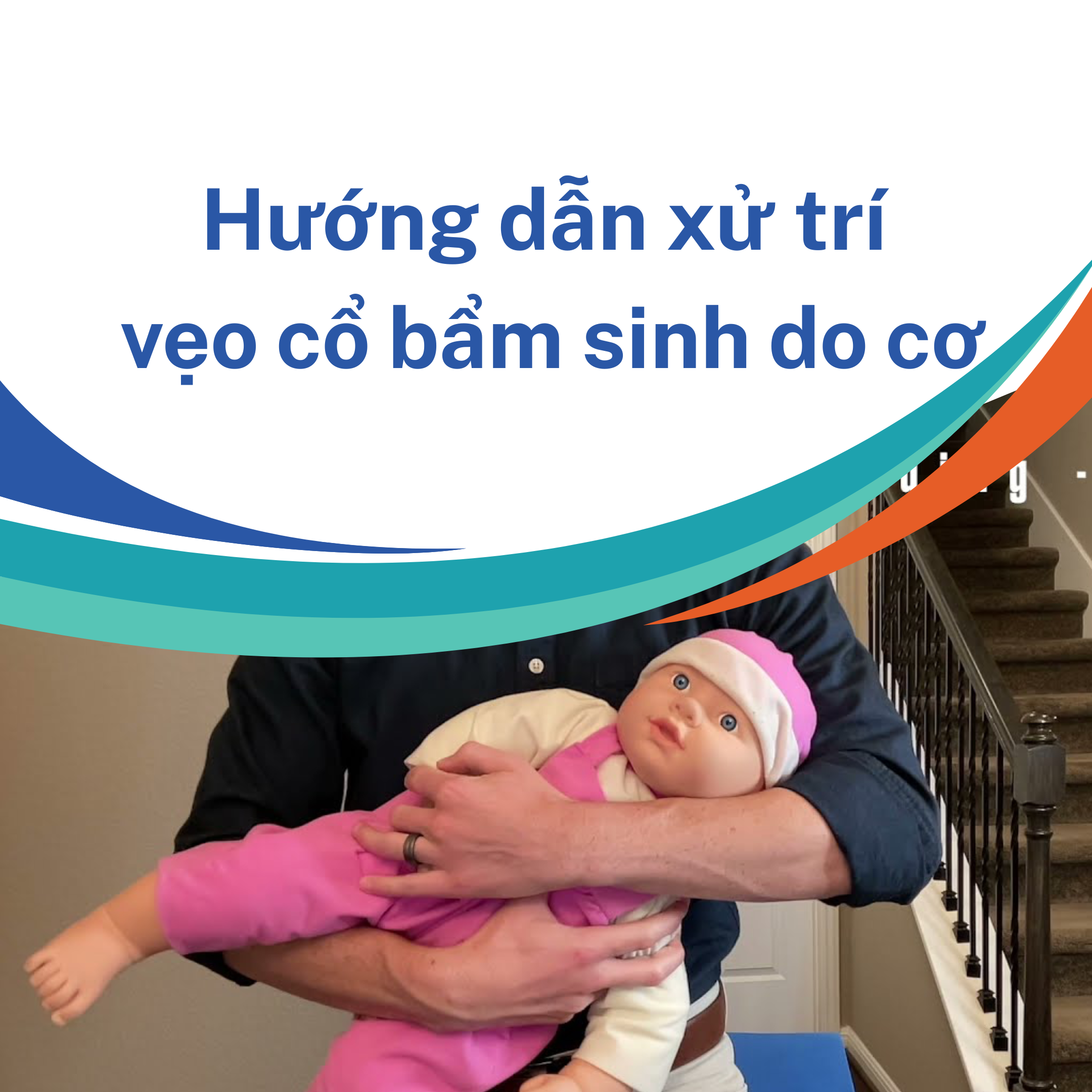 TÓM TẮT HƯỚNG DẪN XỬ TRÍ VẸO CỔ BẨM SINH DO CƠ 