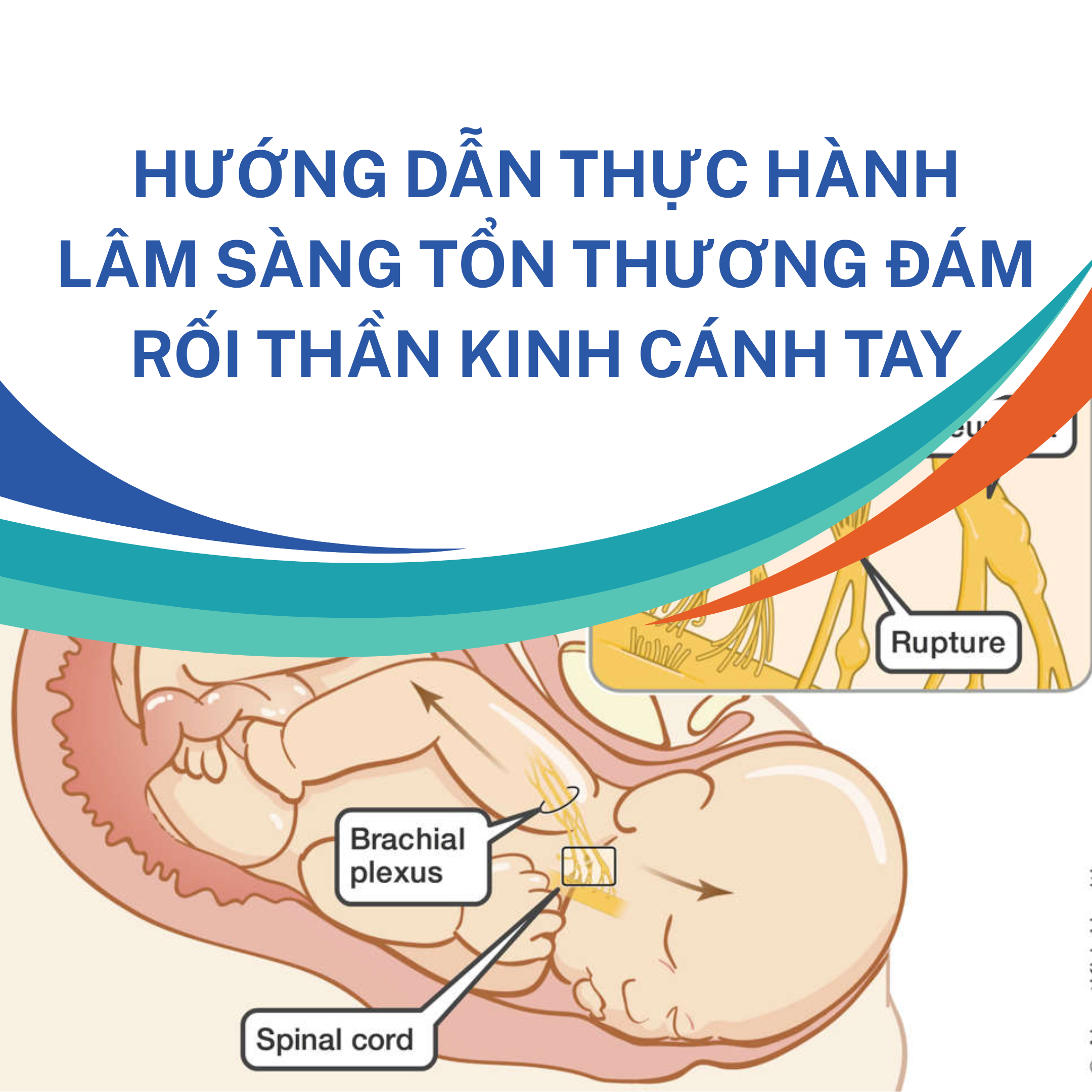 HƯỚNG DẪN THỰC HÀNH LÂM SÀNG TỔN THƯƠNG ĐÁM RỐI THẦN KINH CÁNH TAY 